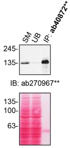 Immunoprecipitation - Anti-Hamartin antibody [EP318Y] - BSA and Azide free (AB247297)