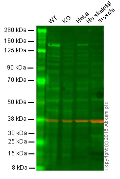Western blot - Anti-Hamartin antibody [EP318Y] - BSA and Azide free (AB247297)