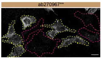 Immunocytochemistry/ Immunofluorescence - Anti-Hamartin antibody [EPR24364-109] - BSA and Azide free (AB282016)
