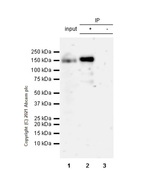 Immunoprecipitation - Anti-Hamartin antibody [EPR24364-109] - BSA and Azide free (AB282016)