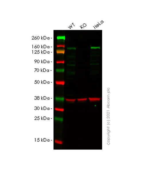 Western blot - Anti-Hamartin antibody [EPR24364-109] - BSA and Azide free (AB282016)