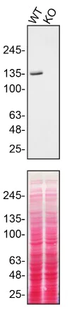 Western blot - Anti-Hamartin antibody [EPR24364-109] - BSA and Azide free (AB282016)