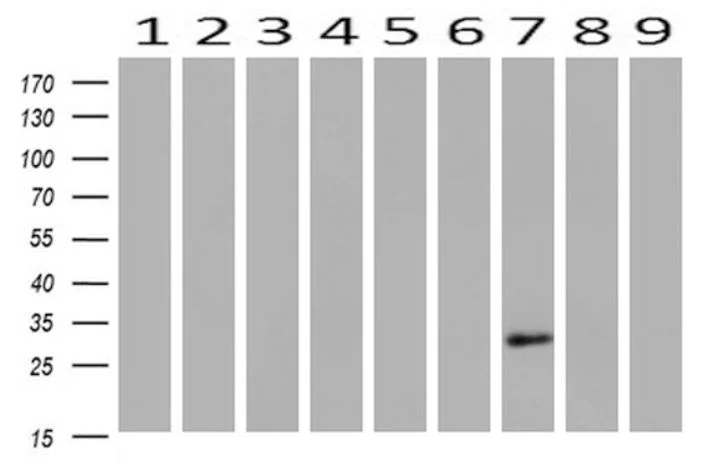 Western blot - Anti-HAND1 antibody [OTI1G10] (AB279390)