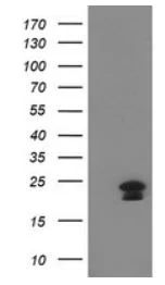 Western blot - Anti-HAND1 antibody [OTI1G10] (AB279390)