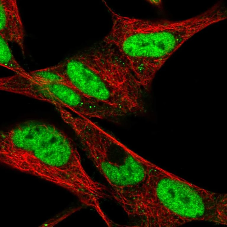 Immunocytochemistry/ Immunofluorescence - Anti-HAND2 Antibody (AB327197)