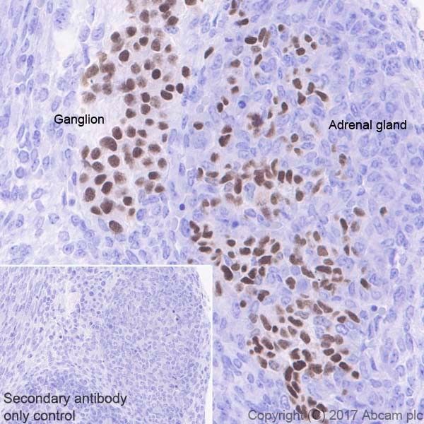 Immunohistochemistry (Formalin/PFA-fixed paraffin-embedded sections) - Anti-HAND2 antibody [EPR19451] (AB200040)