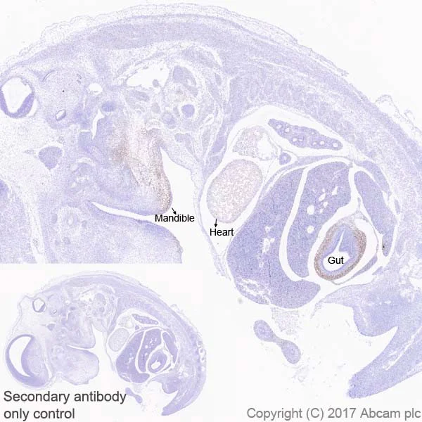 Immunohistochemistry (Formalin/PFA-fixed paraffin-embedded sections) - Anti-HAND2 antibody [EPR19451] (AB200040)