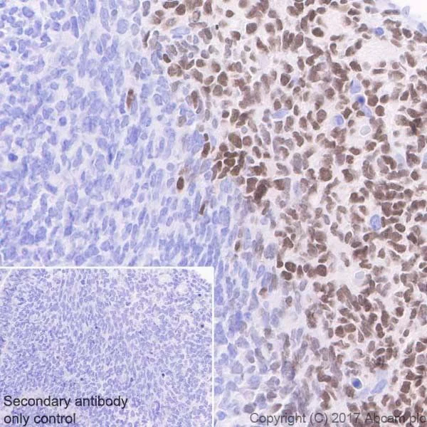 Immunohistochemistry (Formalin/PFA-fixed paraffin-embedded sections) - Anti-HAND2 antibody [EPR19451] (AB200040)