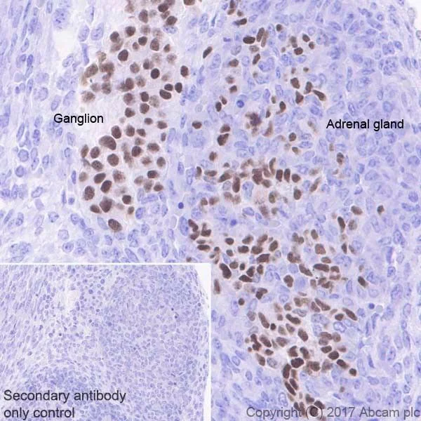 Immunohistochemistry (Formalin/PFA-fixed paraffin-embedded sections) - Anti-HAND2 antibody [EPR19451] - BSA and Azide free (AB240353)