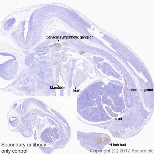 Immunohistochemistry (Formalin/PFA-fixed paraffin-embedded sections) - Anti-HAND2 antibody [EPR19451] - BSA and Azide free (AB240353)