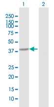 Western blot - Anti-HAO1/GOX antibody (AB172573)
