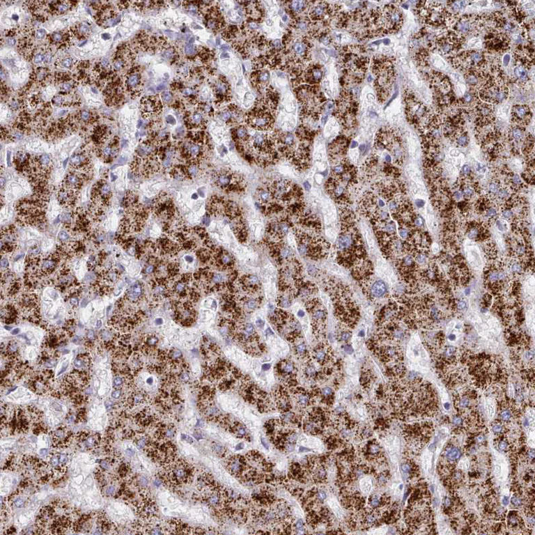Immunohistochemistry (Formalin/PFA-fixed paraffin-embedded sections) - Anti-HAO1/GOX antibody (AB224577)
