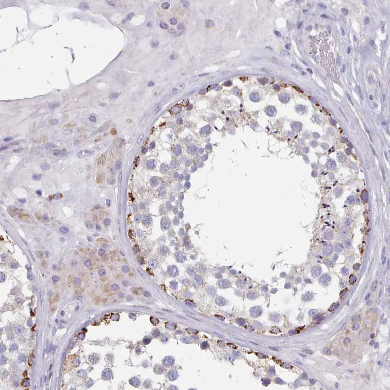 Immunohistochemistry (Formalin/PFA-fixed paraffin-embedded sections) - Anti-HAO1/GOX antibody (AB224577)