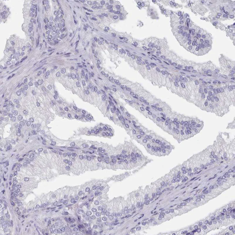 Immunohistochemistry (Formalin/PFA-fixed paraffin-embedded sections) - Anti-HAO1/GOX antibody (AB224577)