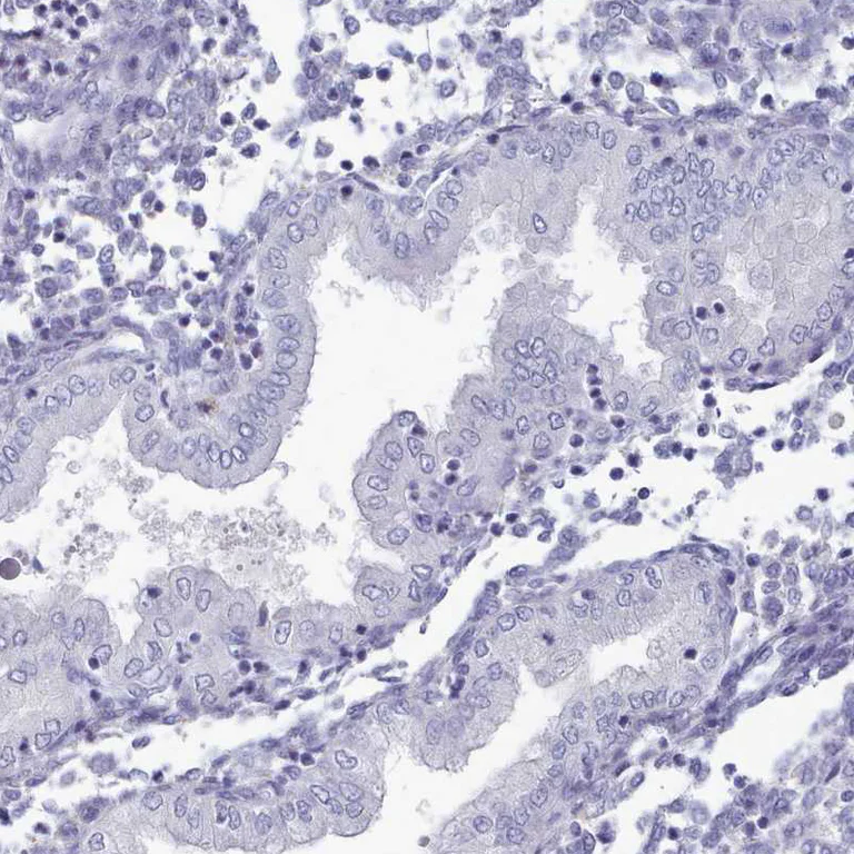 Immunohistochemistry (Formalin/PFA-fixed paraffin-embedded sections) - Anti-HAO1/GOX antibody (AB224577)