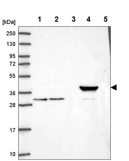 Western blot - Anti-HAO1/GOX antibody (AB224577)