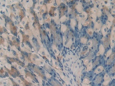 Immunohistochemistry (Formalin/PFA-fixed paraffin-embedded sections) - Anti-HAO1/GOX antibody (AB233150)
