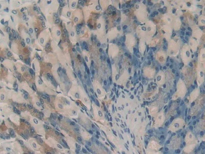 Immunohistochemistry (Formalin/PFA-fixed paraffin-embedded sections) - Anti-HAO1/GOX antibody (AB233150)