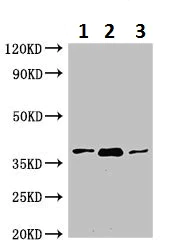 Western blot - Anti-HAO2 antibody (AB229817)