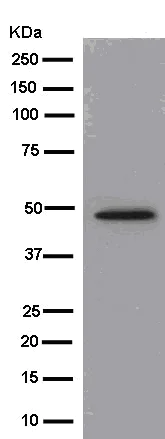 Western blot - Anti-HAPLN1 antibody [EPR6338] (AB181997)