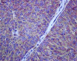 Immunohistochemistry (Formalin/PFA-fixed paraffin-embedded sections) - Anti-HAPLN1 antibody [EPR6338] - BSA and Azide free (AB240257)