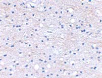 Immunohistochemistry (Formalin/PFA-fixed paraffin-embedded sections) - Anti-HAPLN2 antibody (AB124504)