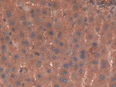 Immunohistochemistry (Formalin/PFA-fixed paraffin-embedded sections) - Anti-Haptoglobin antibody (AB231000)