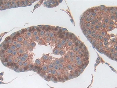 Immunohistochemistry (Formalin/PFA-fixed paraffin-embedded sections) - Anti-Haptoglobin antibody (AB231000)