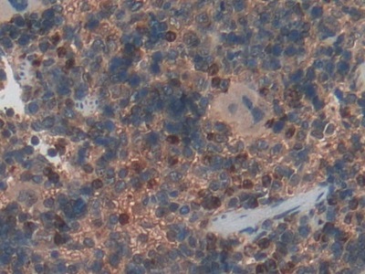 Immunohistochemistry (Formalin/PFA-fixed paraffin-embedded sections) - Anti-Haptoglobin antibody (AB231000)