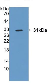 Western blot - Anti-Haptoglobin antibody (AB231000)