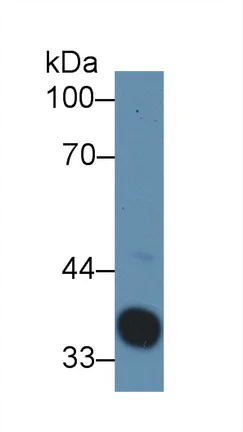 Western blot - Anti-Haptoglobin antibody (AB231000)