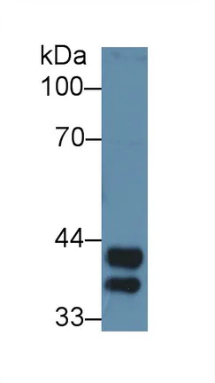 Western blot - Anti-Haptoglobin antibody (AB231000)