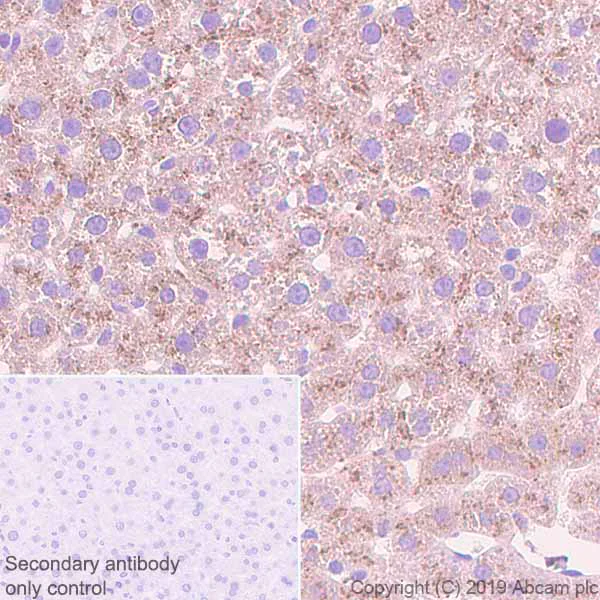 Immunohistochemistry (Formalin/PFA-fixed paraffin-embedded sections) - Anti-Haptoglobin antibody [EPR22856-212] (AB256454)