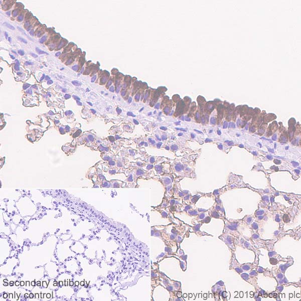 Immunohistochemistry (Formalin/PFA-fixed paraffin-embedded sections) - Anti-Haptoglobin antibody [EPR22856-212] (AB256454), expandable thumbnail