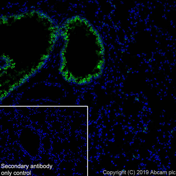 Immunohistochemistry (Frozen sections) - Anti-Haptoglobin antibody [EPR22856-212] (ab256454), expandable thumbnail
