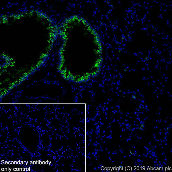 Immunohistochemistry (Frozen sections) - Anti-Haptoglobin antibody [EPR22856-212] (AB256454)