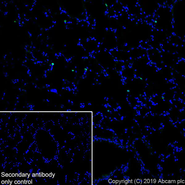 Immunohistochemistry (Frozen sections) - Anti-Haptoglobin antibody [EPR22856-212] (AB256454)