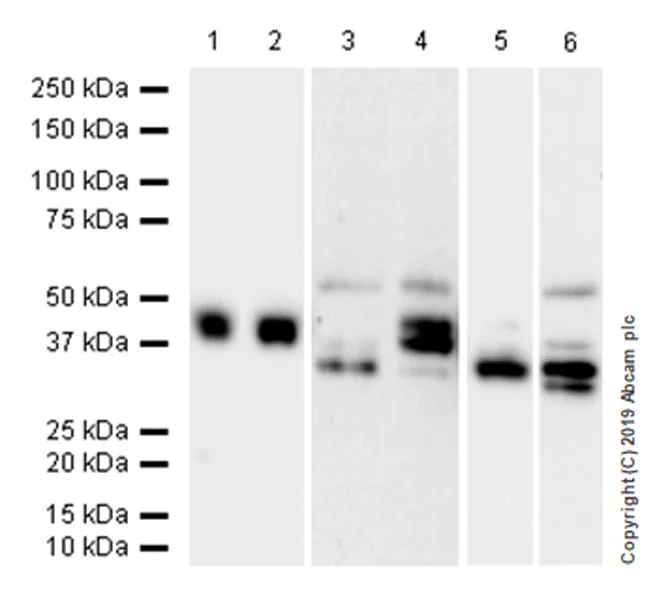 Western blot - Anti-Haptoglobin antibody [EPR22856-212] (AB256454)