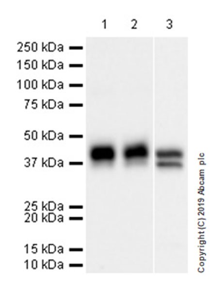 Western blot - Anti-Haptoglobin antibody [EPR22856-212] (AB256454), expandable thumbnail