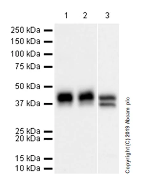 Western blot - Anti-Haptoglobin antibody [EPR22856-212] (AB256454)