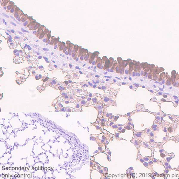Immunohistochemistry (Formalin/PFA-fixed paraffin-embedded sections) - Anti-Haptoglobin antibody [EPR22856-212] - BSA and Azide free (AB261918)