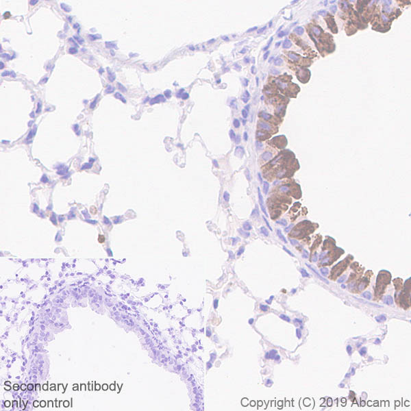 Immunohistochemistry (Formalin/PFA-fixed paraffin-embedded sections) - Anti-Haptoglobin antibody [EPR22856-233] (AB256455), expandable thumbnail