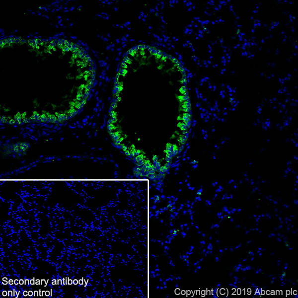 Immunohistochemistry (Frozen sections) - Anti-Haptoglobin antibody [EPR22856-233] (AB256455), expandable thumbnail