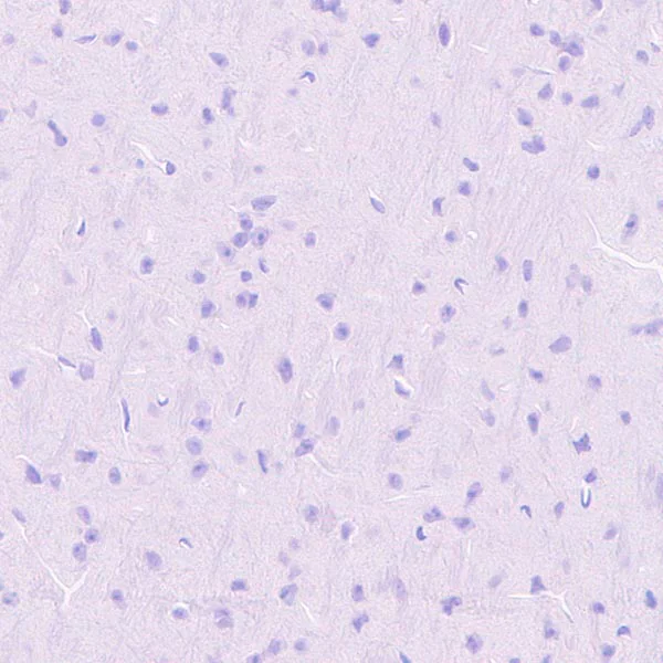 Immunohistochemistry (Formalin/PFA-fixed paraffin-embedded sections) - Anti-Haptoglobin antibody [EPR22856-233] - BSA and Azide free (AB261725)