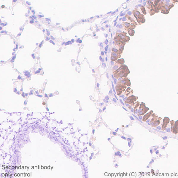 Immunohistochemistry (Formalin/PFA-fixed paraffin-embedded sections) - Anti-Haptoglobin antibody [EPR22856-233] - BSA and Azide free (AB261725)