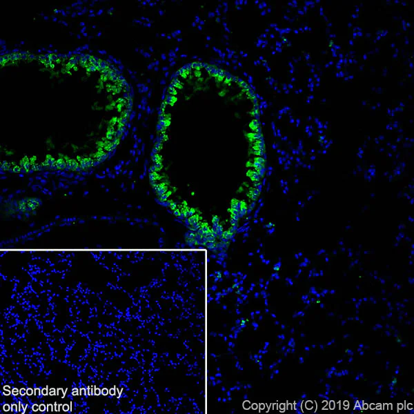 Immunohistochemistry (Frozen sections) - Anti-Haptoglobin antibody [EPR22856-233] - BSA and Azide free (AB261725)