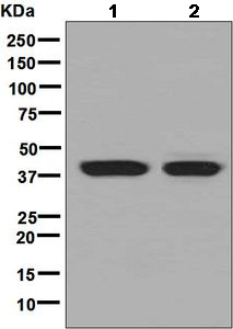 Western blot - Anti-Haptoglobin antibody [EPSISR7] (AB131236)