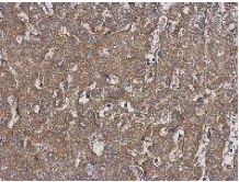 Immunohistochemistry (Formalin/PFA-fixed paraffin-embedded sections) - Anti-HARS antibody (AB137591)