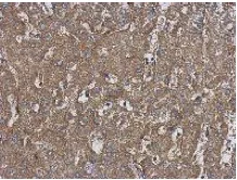 Immunohistochemistry (Formalin/PFA-fixed paraffin-embedded sections) - Anti-HARS antibody (AB137591)