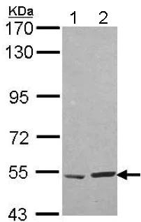 Western blot - Anti-HARS antibody (AB137591)